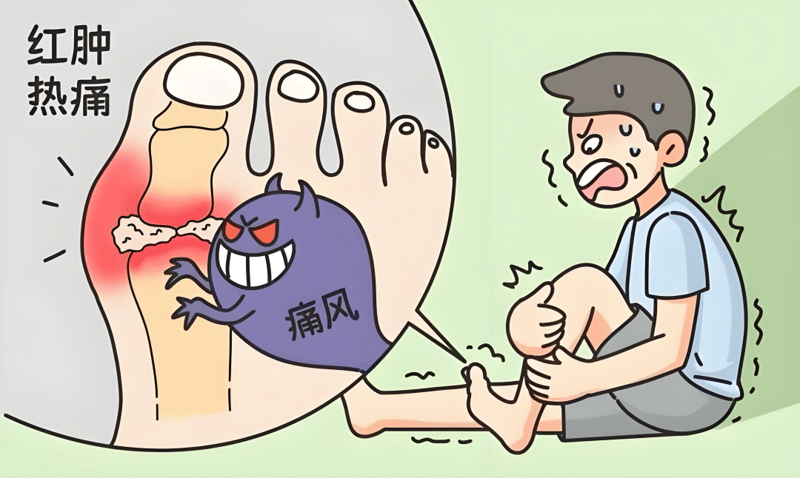 【健康科普】痛风只能“管住嘴”？探秘壮医的传统外治智慧
